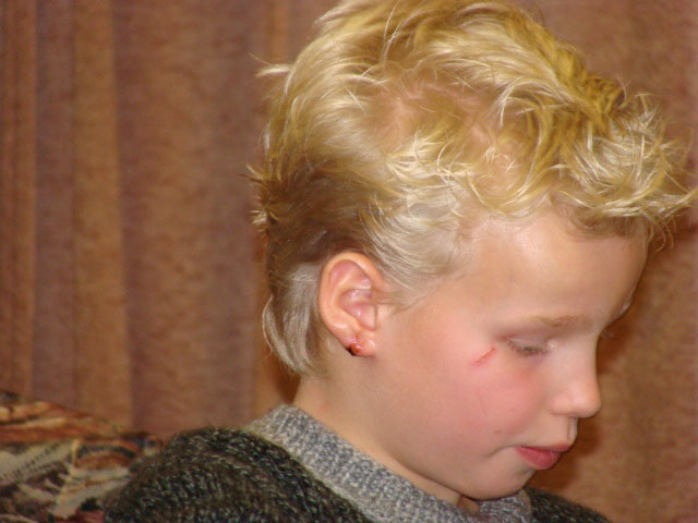 04